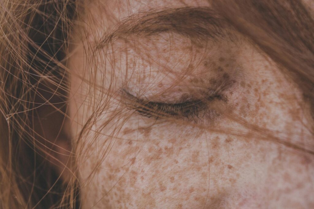 Cât de des ar trebui să mergi la un control dermatologic?